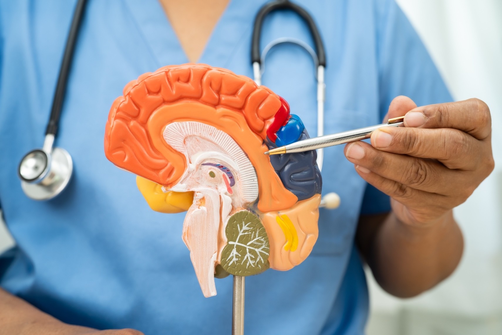 ฝุ่นร้ายทำลายสมอง แพทย์ รพ.วิมุต เตือน สูดฝุ่น “PM2.5” ไม่ใช่แค่ปอดพัง ย้ำคนไทยเลี่ยงวันฝุ่นหนา-สวม N95 เซฟสมองก่อนเป็นอัลไซเมอร์-พาร์กินสันก่อนวัย