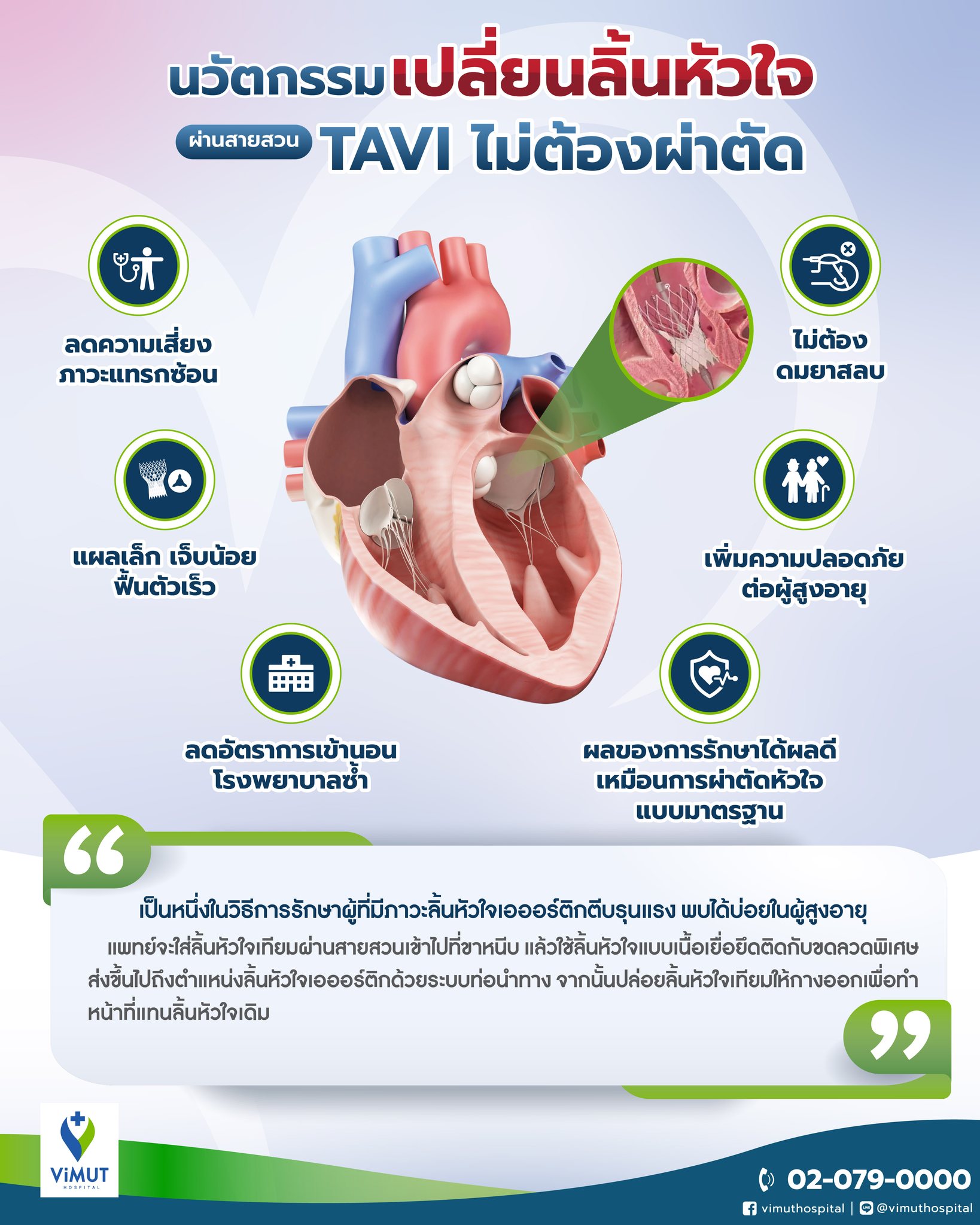เหนื่อยง่าย นอนหงายแล้วอึดอัด อาจเสี่ยง “โรคลิ้นหัวใจ” แพทย์ รพ.วิมุต ชู “TAVI” ทางเลือกใหม่ นวัตกรรมซ่อมลิ้นหัวใจไม่ต้องผ่าตัดเปิดหน้าอก