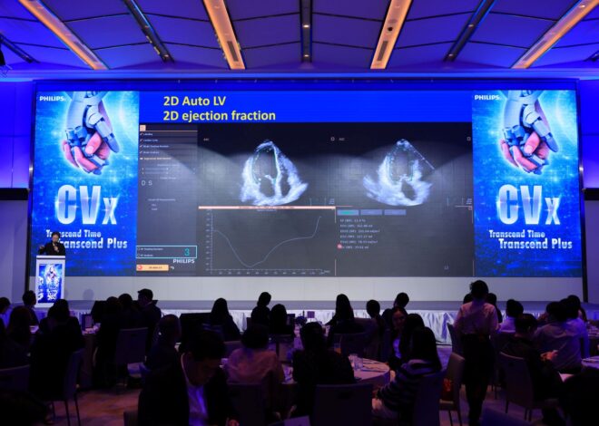 ฟิลิปส์ เปิดตัว Transcend Plus สำหรับอัลตราซาวด์รุ่น EPIQ CVx และ Affiniti CVx ชูจุดเด่นด้านภาพคมชัด และเทคโนโลยี AI ที่ผ่านการรับรองจากองค์การอาหารและยา ประเทศสหรัฐอเมริกา