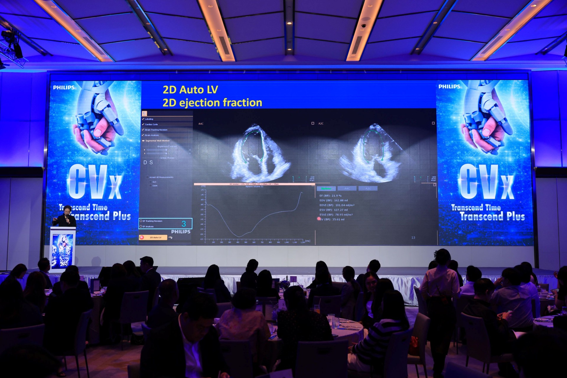 ฟิลิปส์ เปิดตัว Transcend Plus สำหรับอัลตราซาวด์รุ่น EPIQ CVx และ Affiniti CVx ชูจุดเด่นด้านภาพคมชัด และเทคโนโลยี AI ที่ผ่านการรับรองจากองค์การอาหารและยา ประเทศสหรัฐอเมริกา